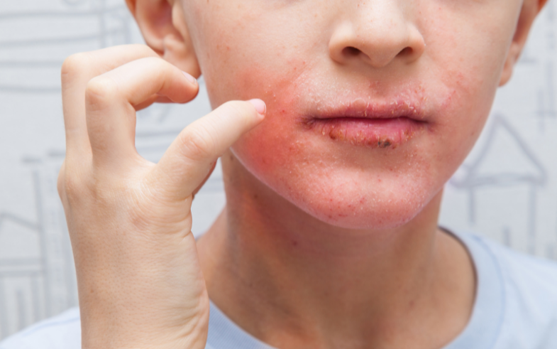 7 Most Common Skin Care Ingredients That Can Trigger Allergic Reactions