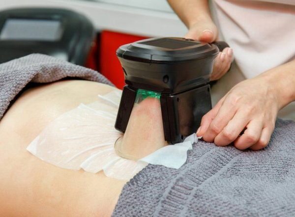 Does Fat Freezing Really Work? Debunking Myths and Sharing Results